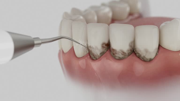 Reliable Dental contractor in Schoolcraft, MI by Dentist Open Now